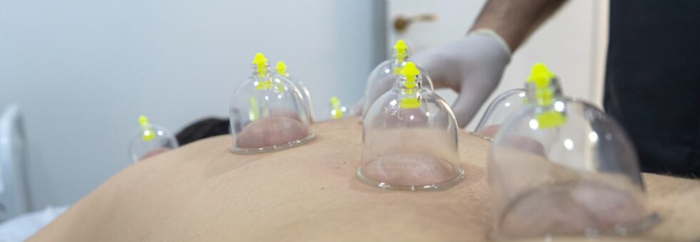 İstanbul hacamat kliniğinde steril ortamda kupa terapisi uygulaması